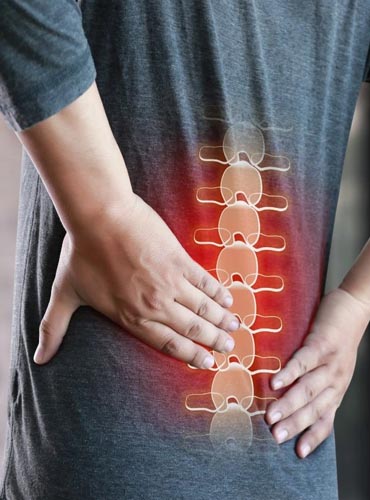 Ankylosing Spondylitis