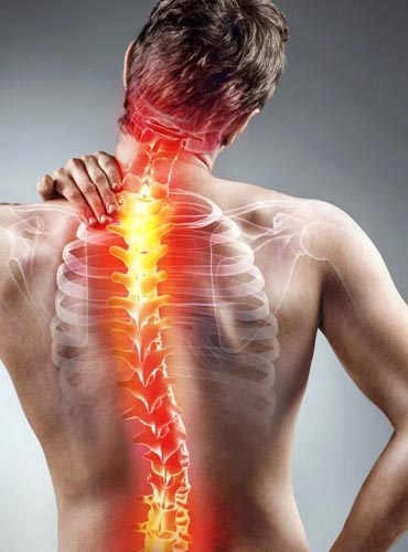 Cervical and Lumbar Spondylitis Physiotherapy